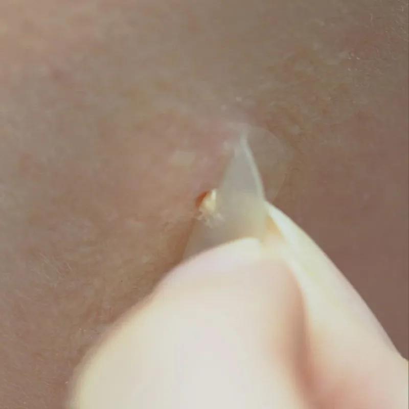 COSRX Master Patch Basic 90τμχ – Επιθέματα Σπυριών Προσώπου για Σπυράκια, Προστασία & Επανόρθωση